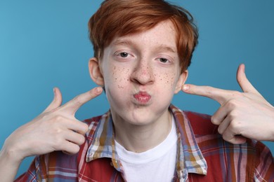 Photo of Funny teenage boy with freckles on light blue background