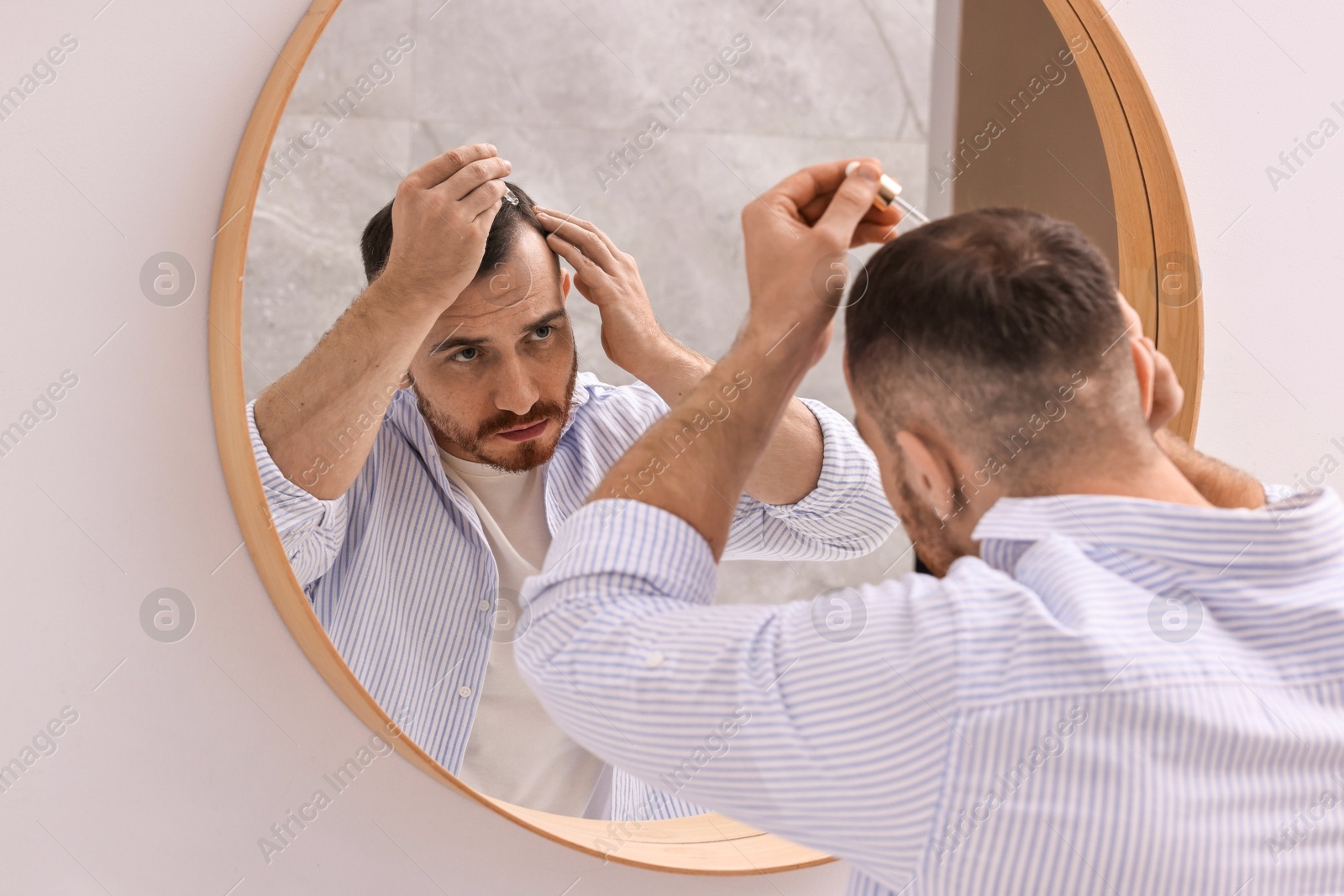 Photo of Baldness problem. Man applying serum onto hairline near mirror in bathroom