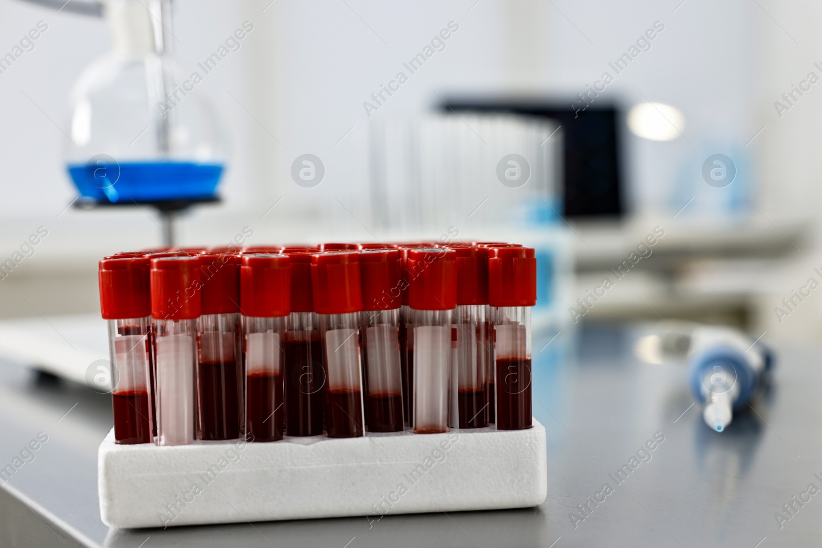 Photo of Tubes with blood samples on table in laboratory, closeup. Space for text