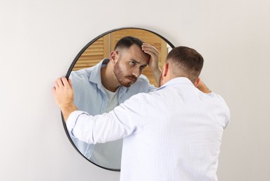 Photo of Baldness problem. Man with receding hairline near mirror at home, back view