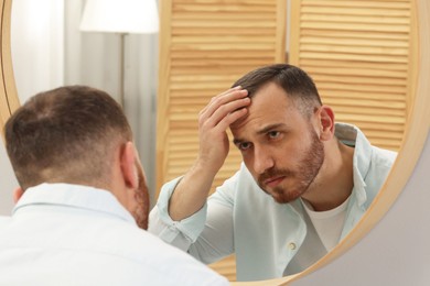 Photo of Baldness problem. Man with receding hairline near mirror at home