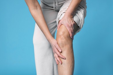 Photo of Woman suffering from pain in her knee on light blue background, closeup