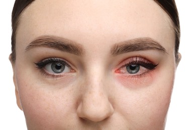 Image of Conjunctivitis. Young woman with bloodshot in eye on white background, closeup