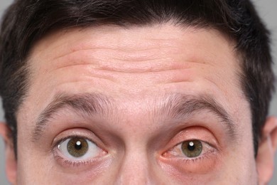 Image of Conjunctivitis. Man with bloodshot in eye, closeup