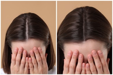 Image of Woman suffering from hair loss problem on dark beige background, closeup. Collage with photos before and after treatment