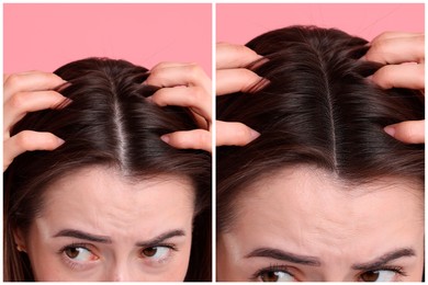 Image of Young woman suffering from hair loss problem on pink background, closeup. Collage with photos before and after treatment