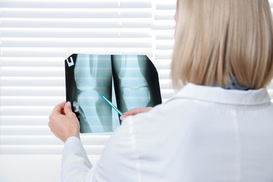 Photo of Doctor with pen examining knee x-ray in clinic