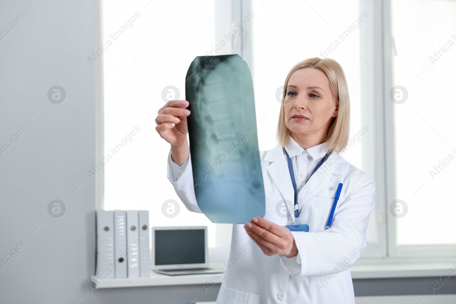 Photo of Doctor examining x-ray image of backbone near window in clinic