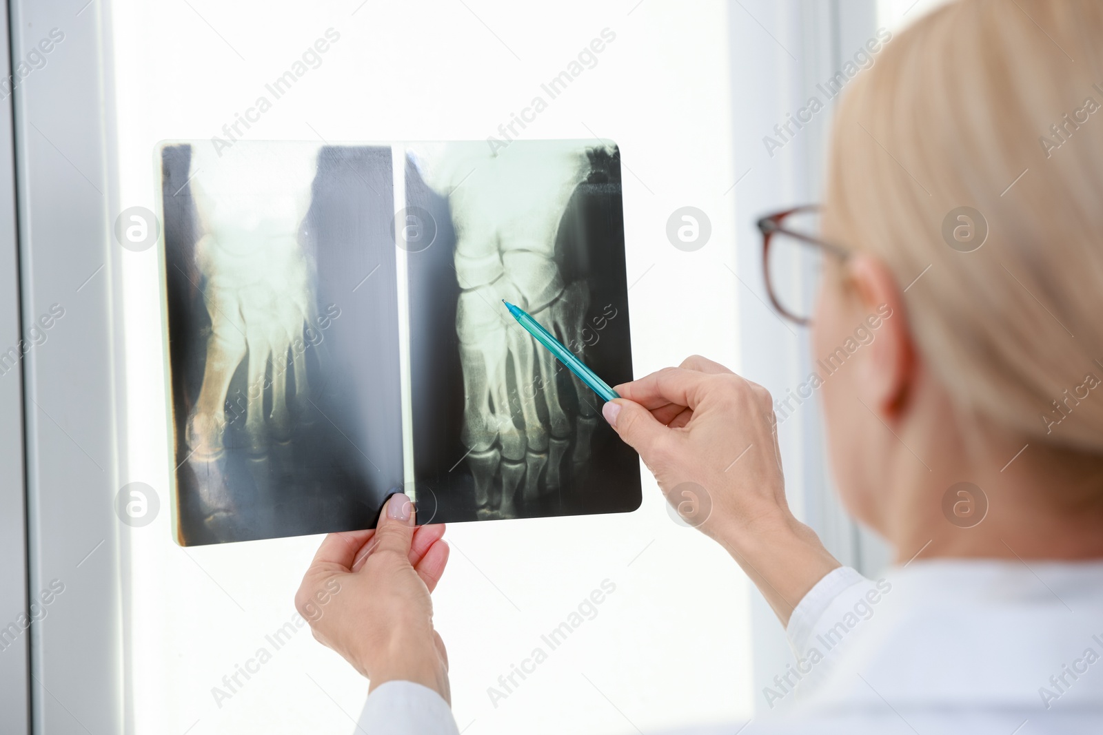 Photo of Doctor with pen examining x-ray image of foot near window in clinic