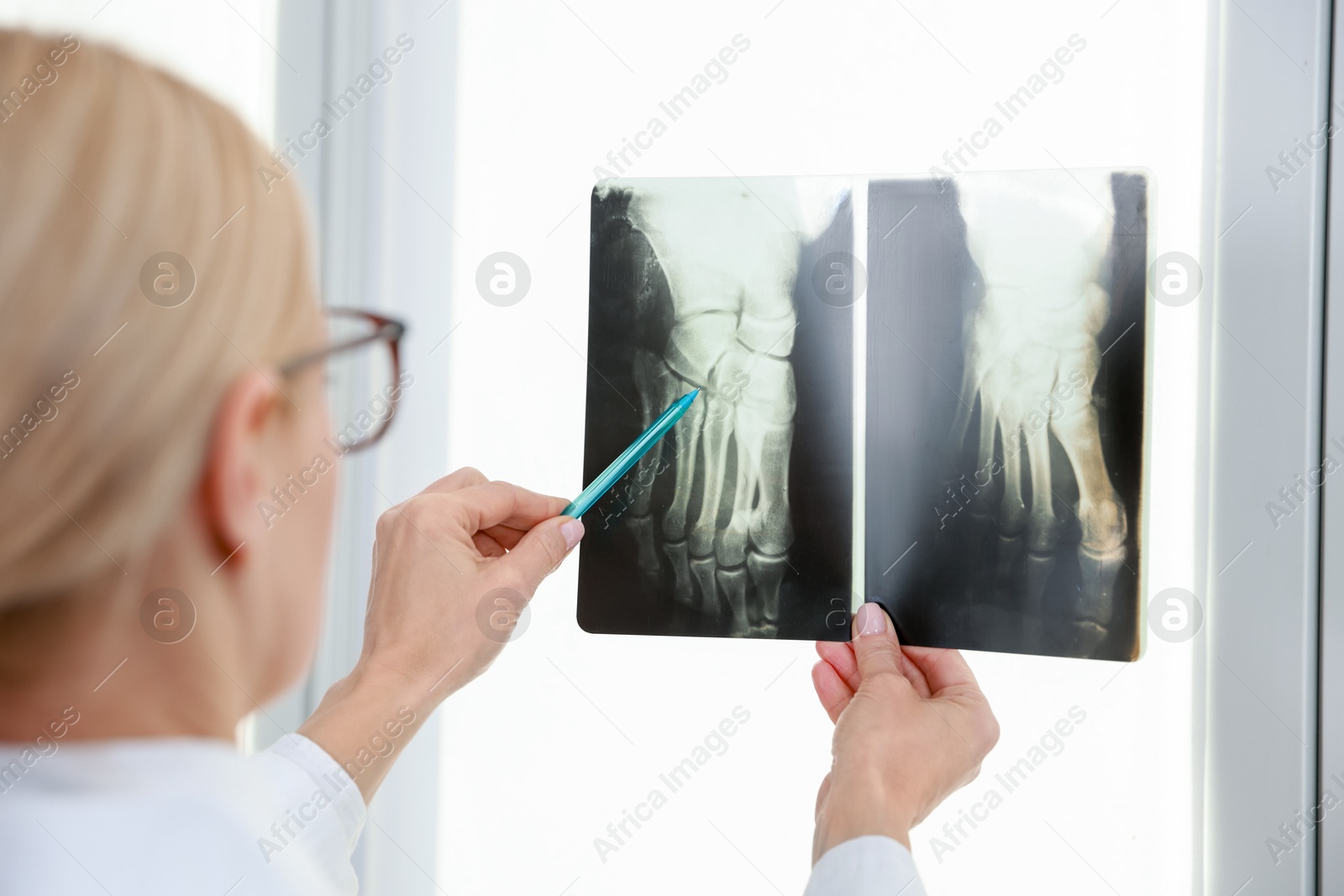 Photo of Doctor with pen examining x-ray image of foot near window in clinic