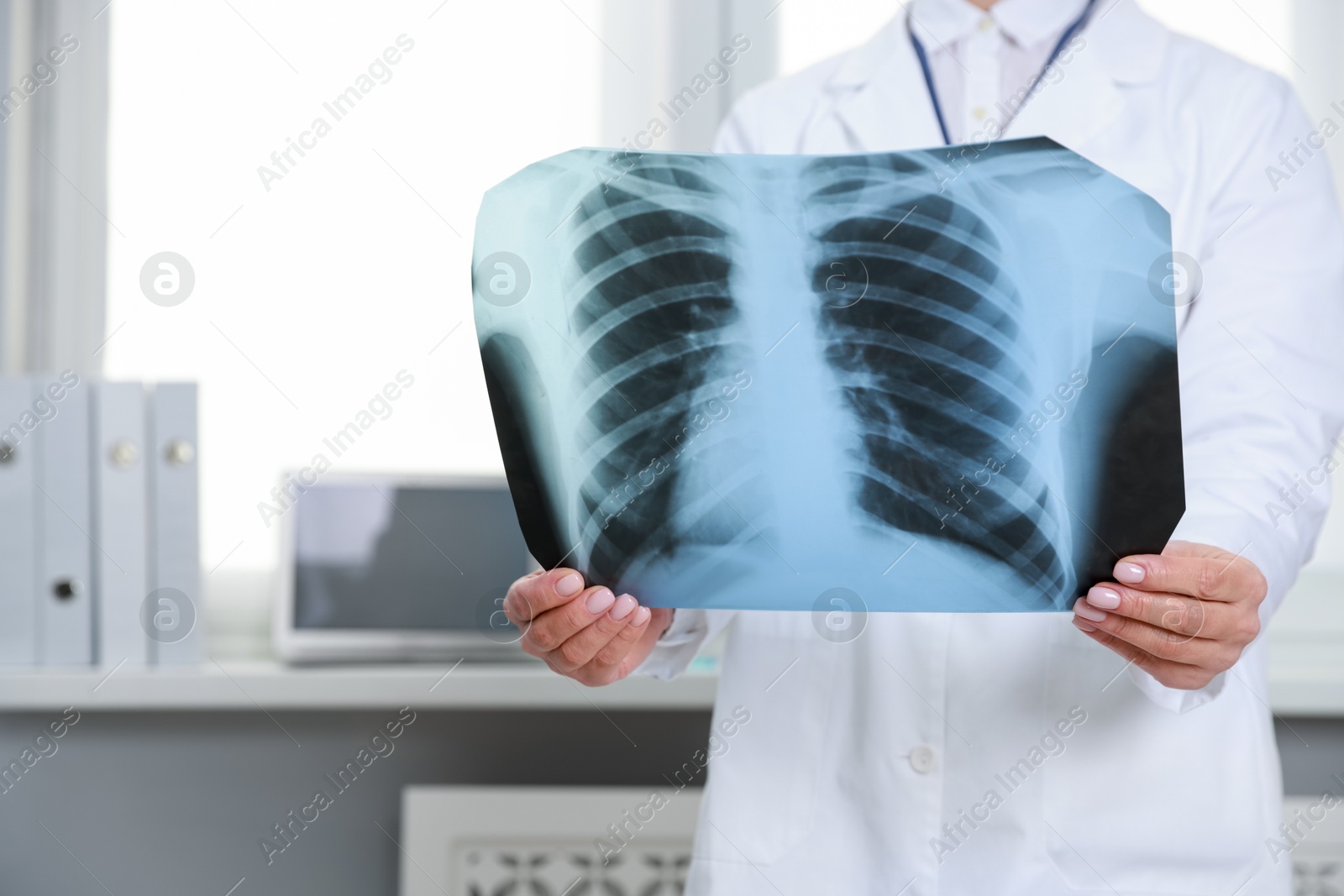 Photo of Doctor examining foot x-ray in clinic, closeup. Space for text