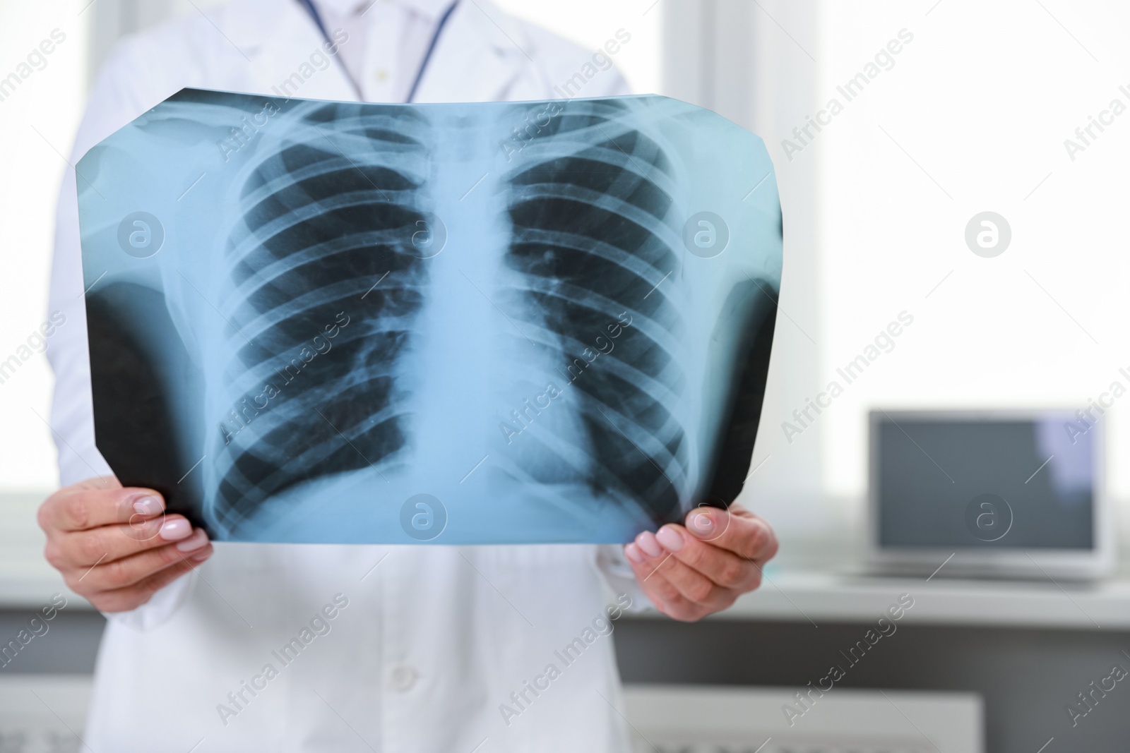 Photo of Doctor examining foot x-ray in clinic, closeup. Space for text