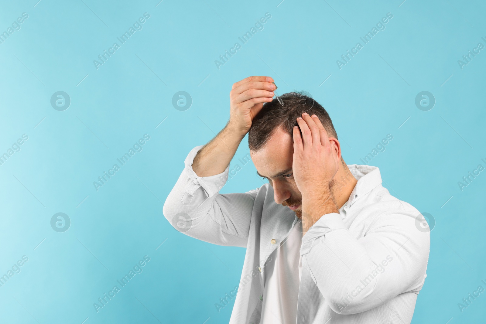 Photo of Baldness treatment. Man applying serum onto hair on light blue background. Space for text