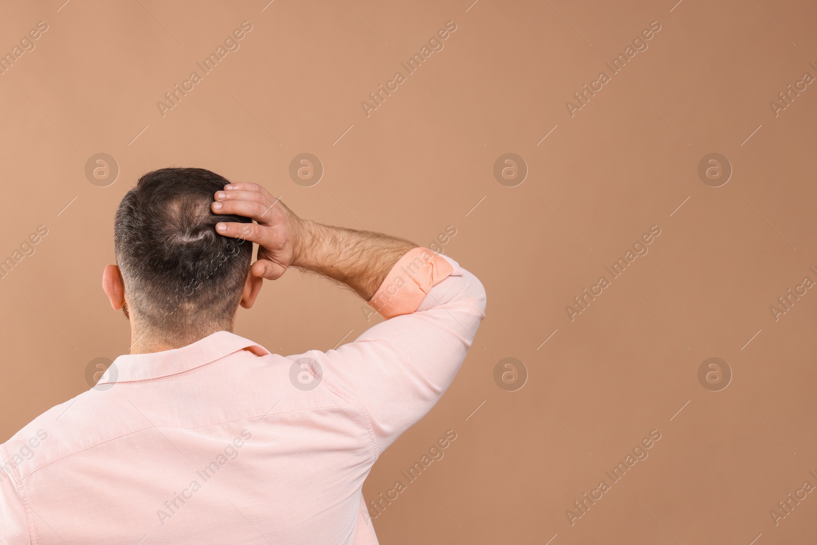 Photo of Baldness problem. Man with bald spot on beige background, back view. Space for text