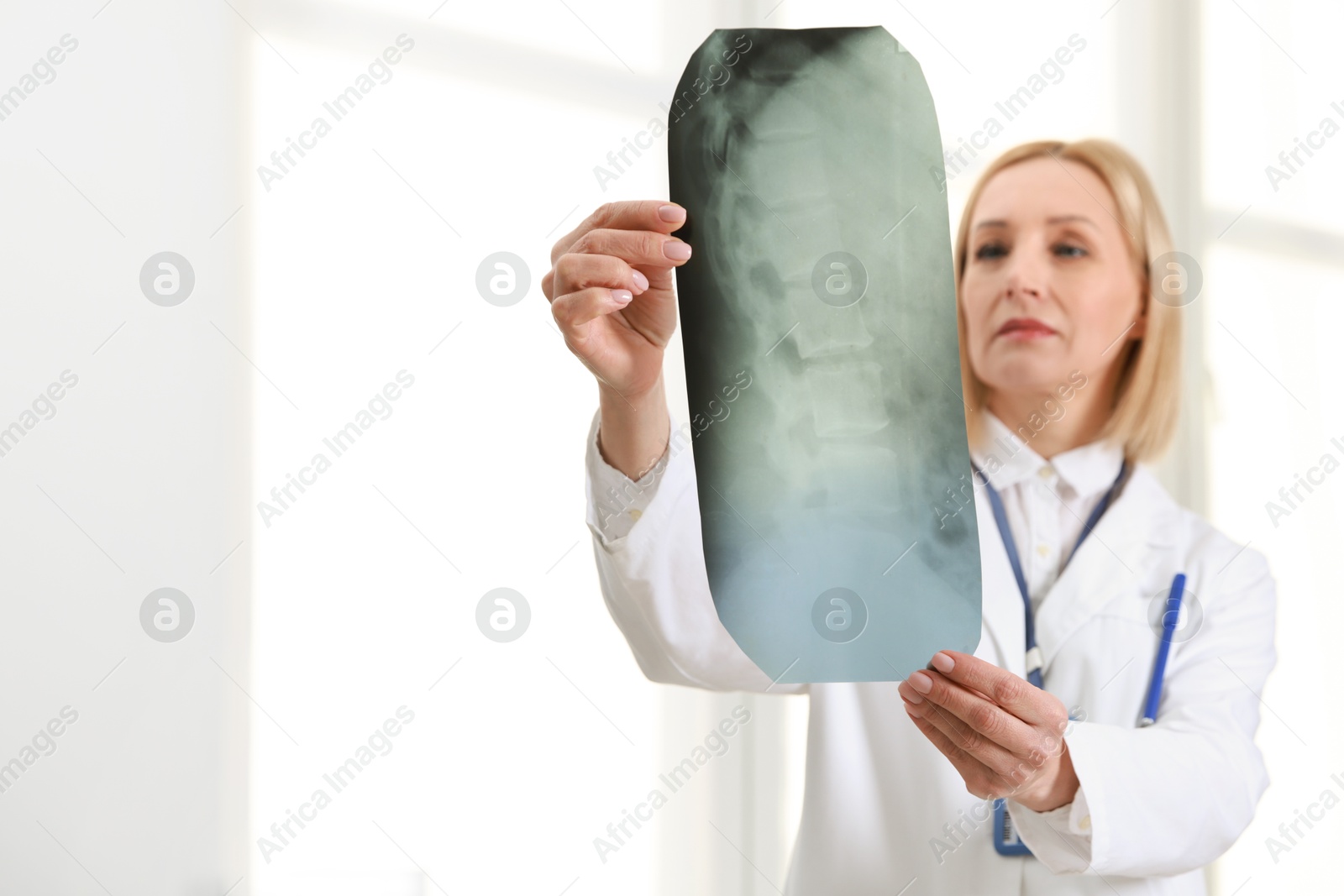 Photo of Doctor examining x-ray image of backbone near window in clinic, selective focus