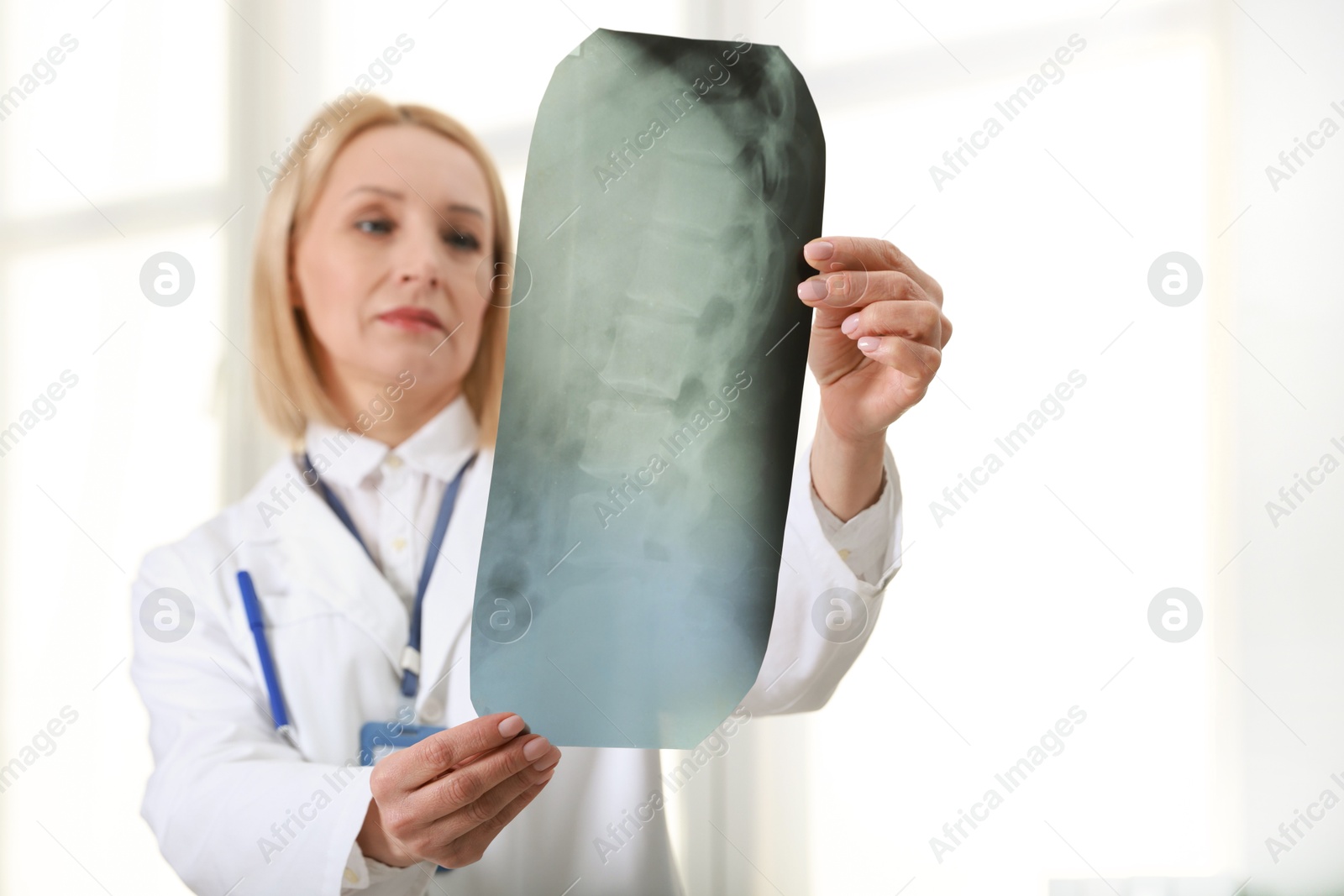 Photo of Doctor examining x-ray image of backbone near window in clinic, selective focus