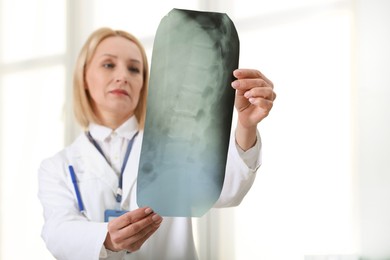 Photo of Doctor examining x-ray image of backbone near window in clinic, selective focus