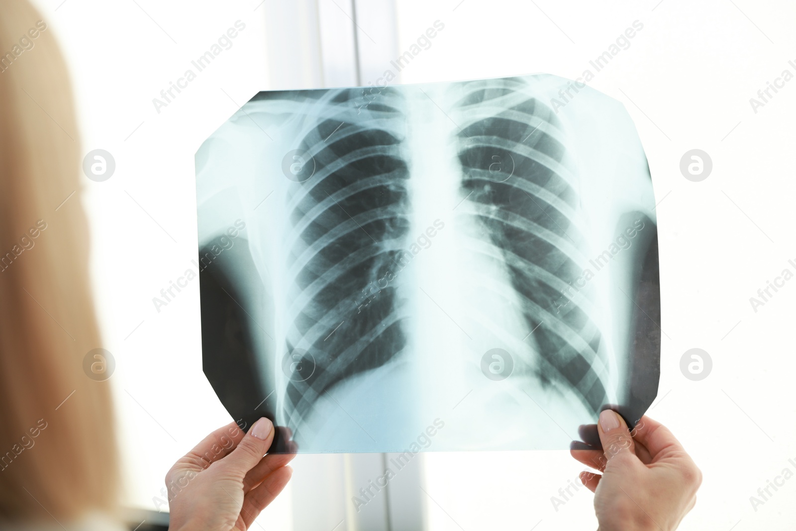 Photo of Doctor examining chest x-ray near window in clinic, closeup