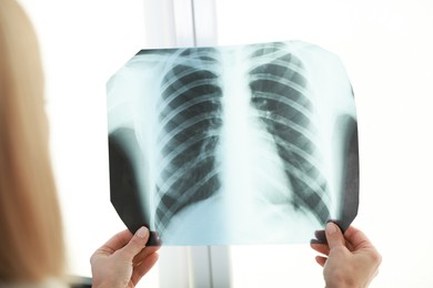 Photo of Doctor examining chest x-ray near window in clinic, closeup