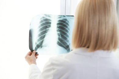 Photo of Doctor examining chest x-ray near window in clinic, back view