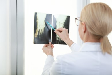 Photo of Doctor with pen examining x-ray image of foot near window in clinic, back view