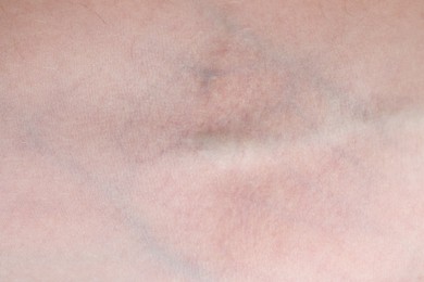 Photo of Texture of healthy skin as background, closeup