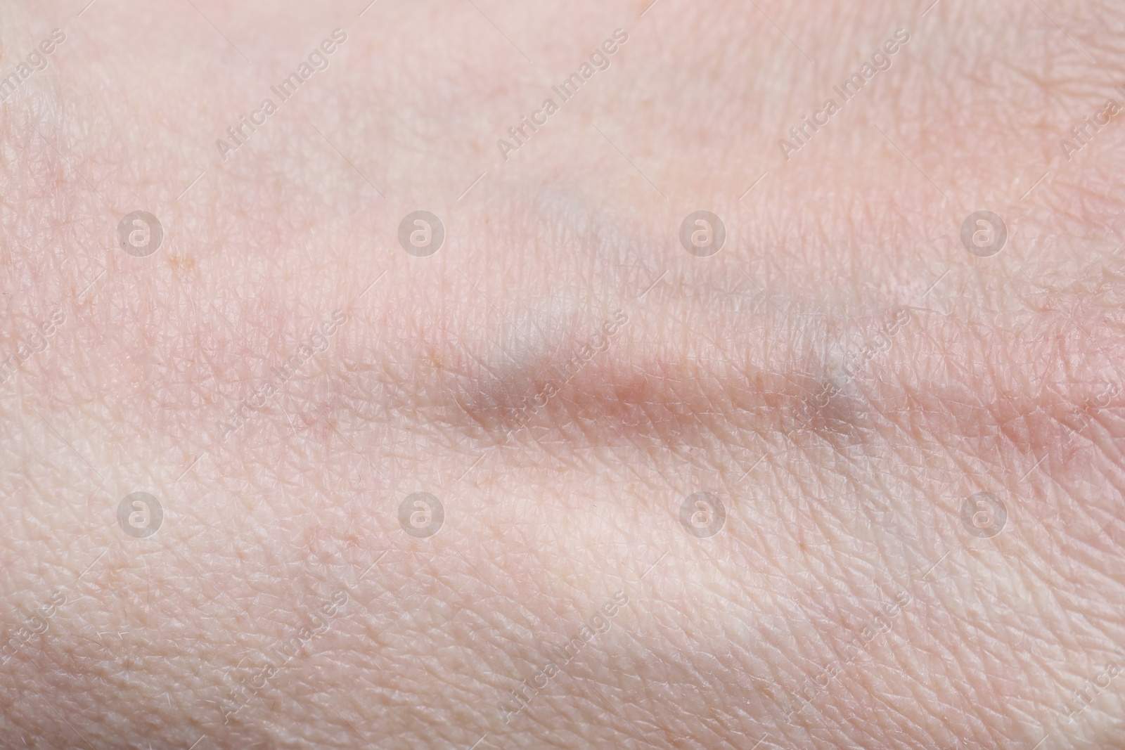 Photo of Texture of healthy skin as background, closeup