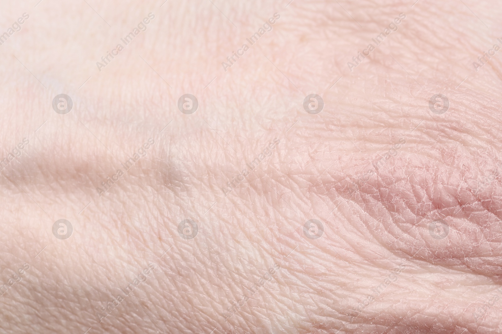 Photo of Texture of healthy skin as background, closeup