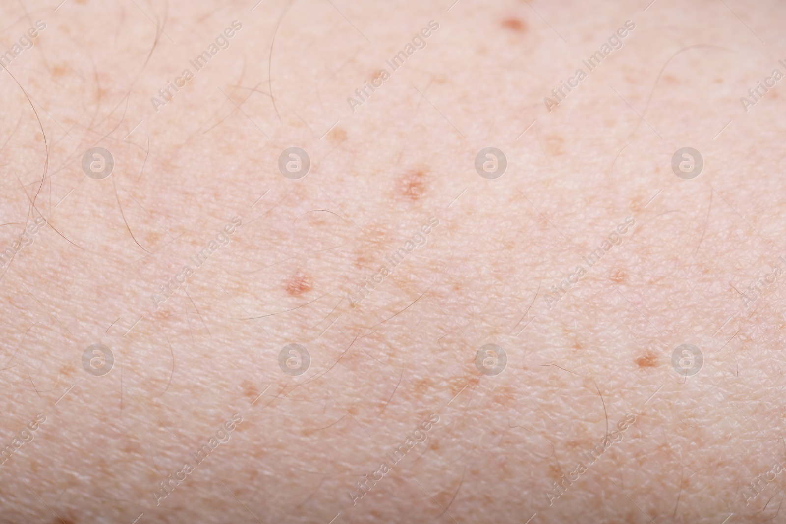 Photo of Texture of healthy skin as background, closeup