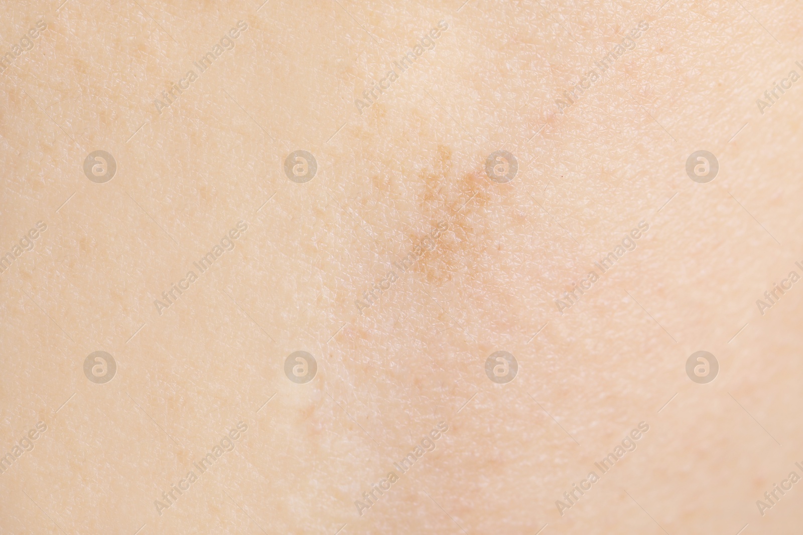 Photo of Texture of healthy skin as background, closeup