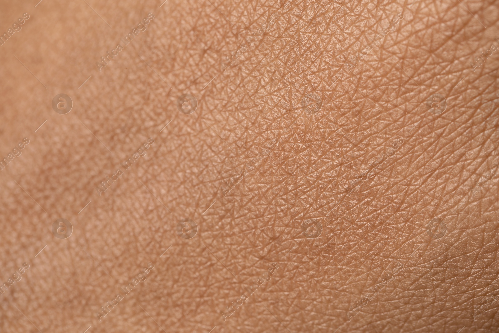 Photo of Macro view of normal skin as background