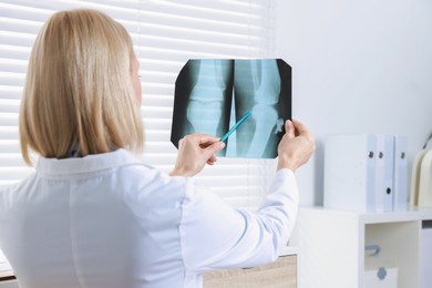 Photo of Doctor with pen examining knee x-ray in clinic, space for text