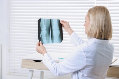 Photo of Doctor examining knee x-ray in clinic, space for text