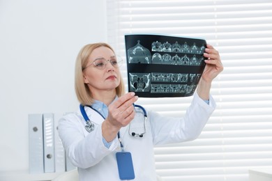 Doctor examining x-ray image of paranasal sinuses in clinic