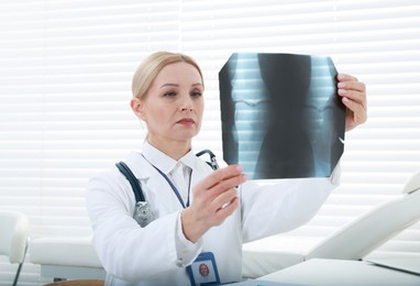 Doctor examining x-ray image of knee at table in clinic