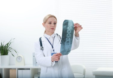 Photo of Doctor examining x-ray image of backbone in clinic