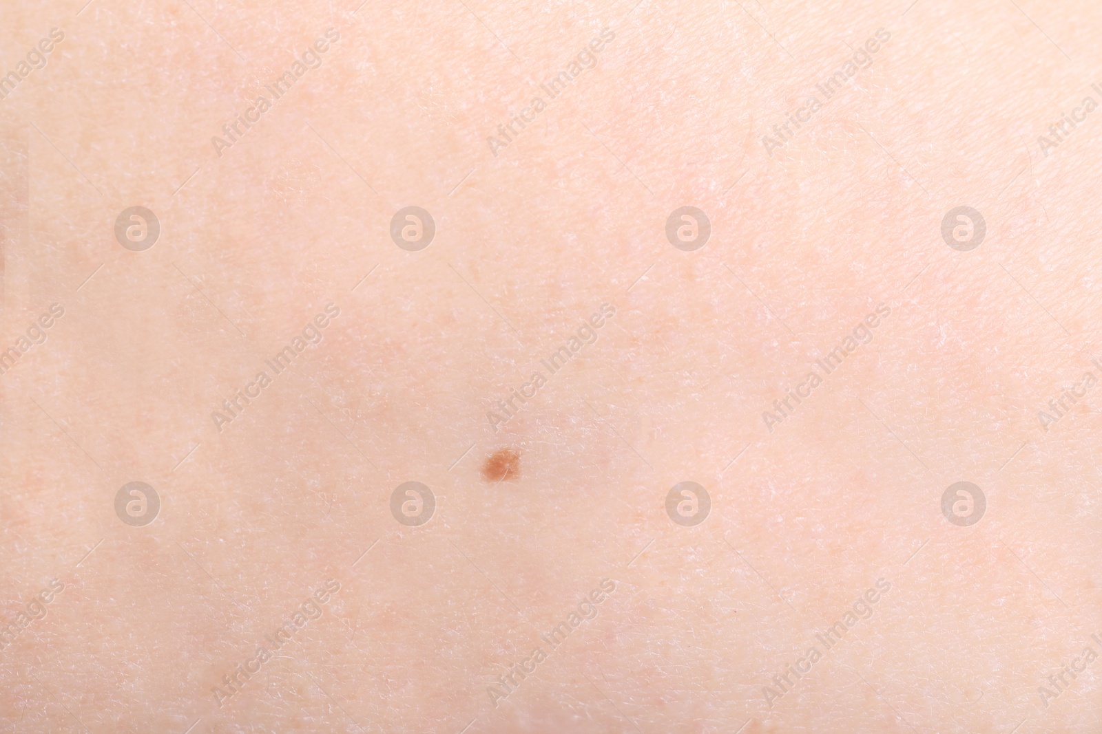 Photo of Texture of healthy skin as background, closeup