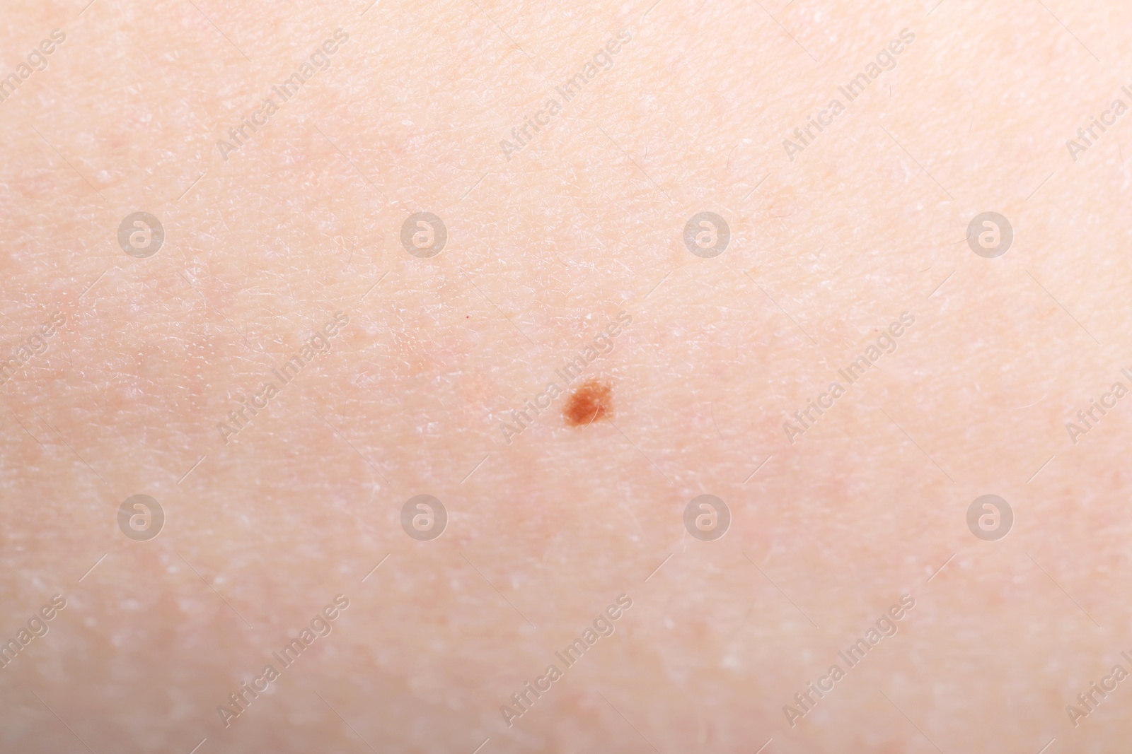 Photo of Texture of healthy skin as background, closeup