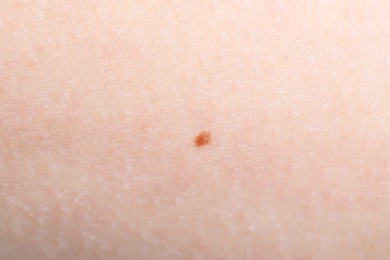 Photo of Texture of healthy skin as background, closeup