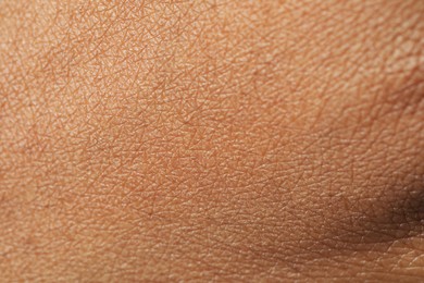 Photo of Macro view of normal skin as background