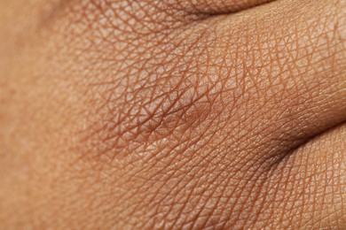 Photo of Macro view of normal skin as background