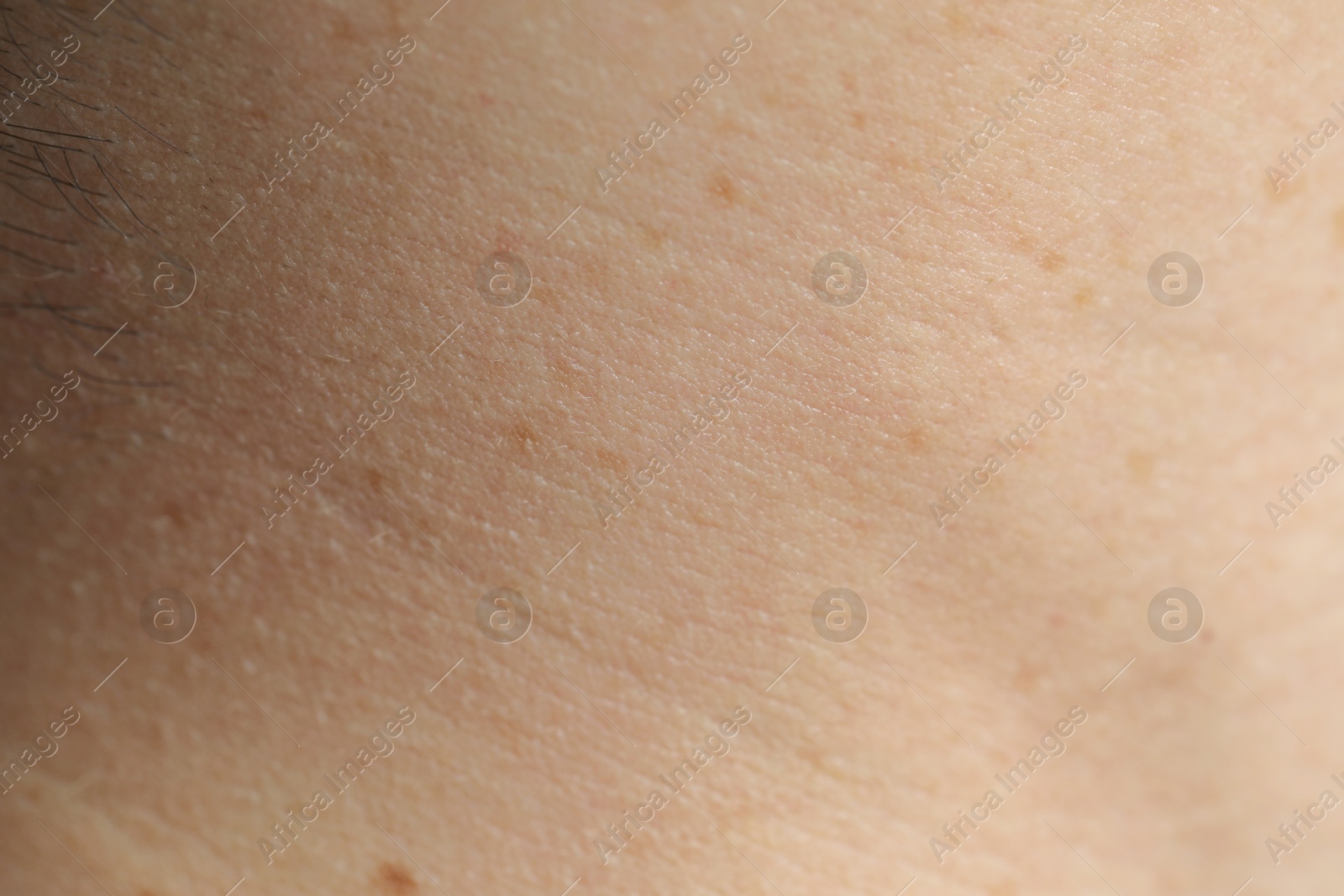 Photo of Texture of normal skin as background, closeup