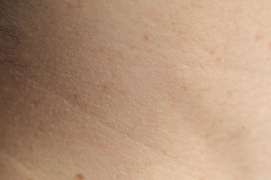 Texture of normal skin as background, closeup