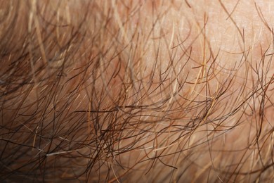 Texture of normal skin and hairs as background, closeup