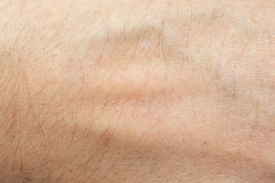 Texture of normal skin as background, closeup