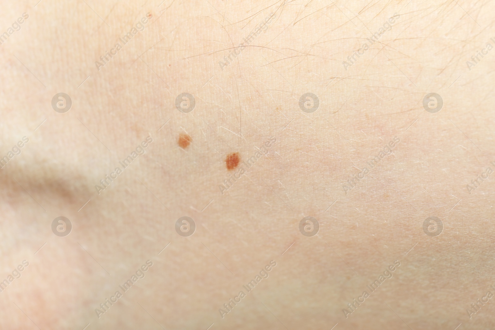 Photo of Texture of normal skin as background, closeup