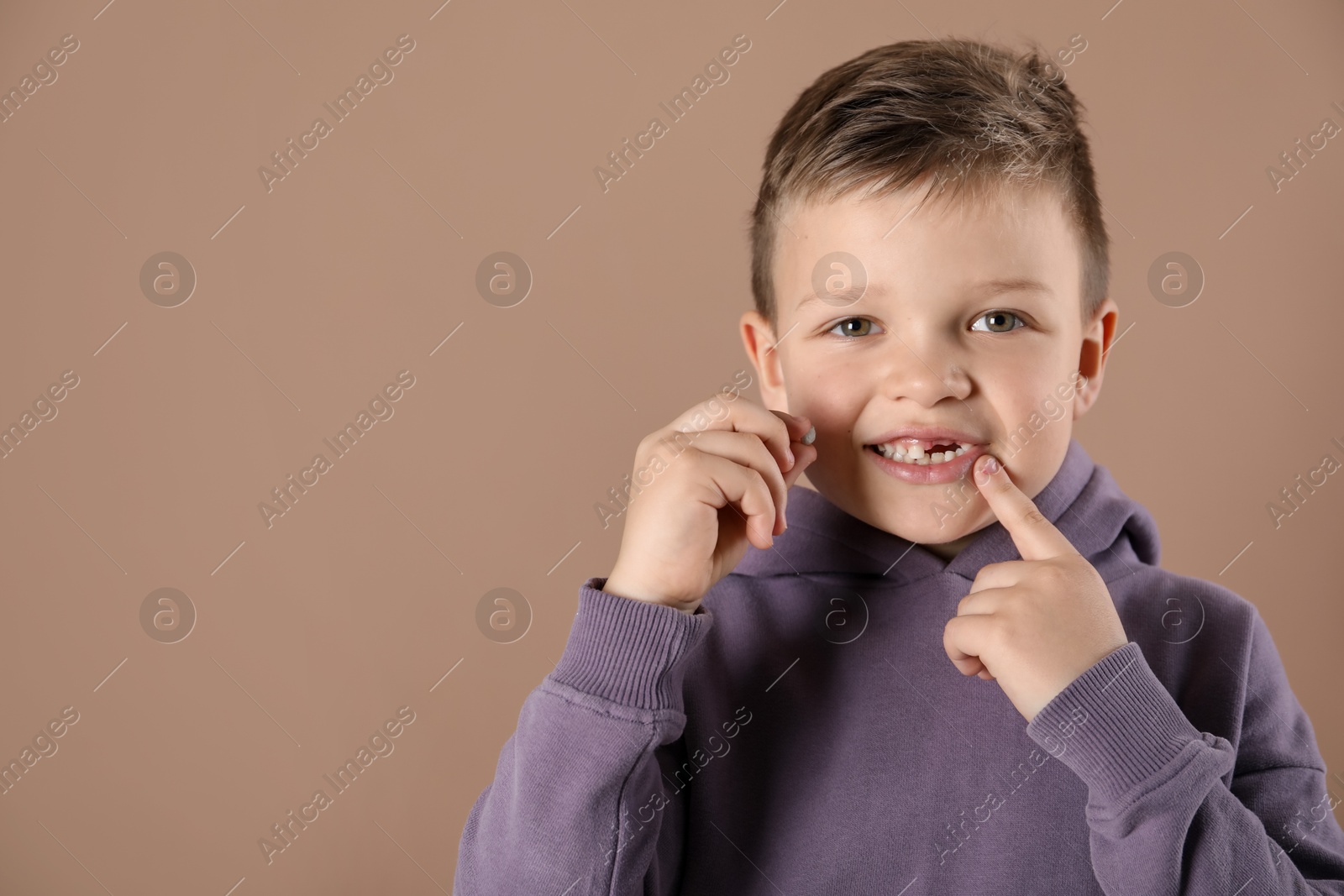 Photo of Cute little boy with missing tooth on dark beige background, space for text. Waiting for tooth fairy