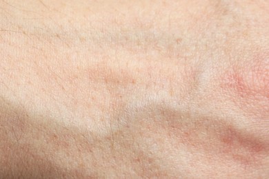 Photo of Texture of normal skin as background, closeup