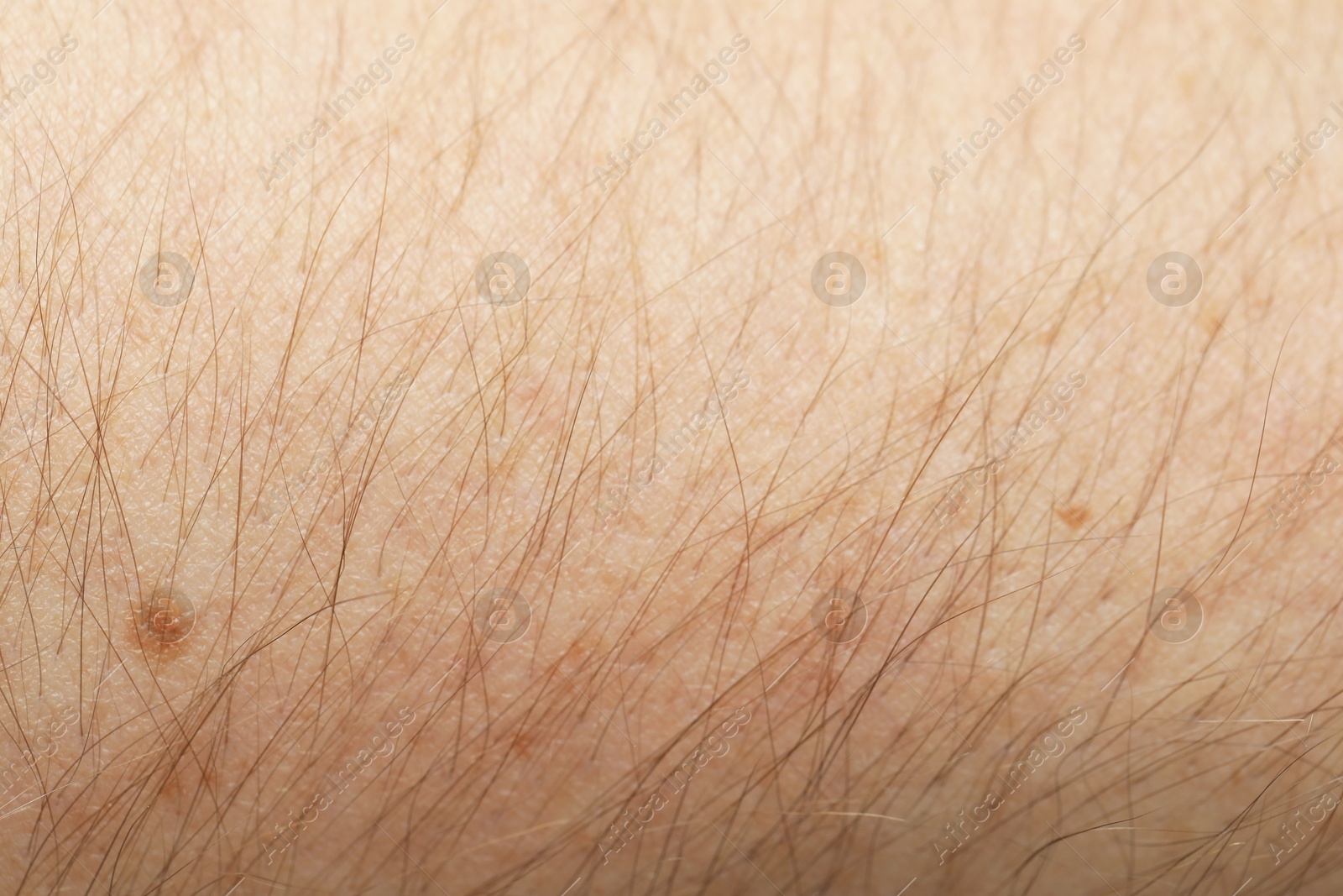 Photo of Texture of normal skin as background, closeup