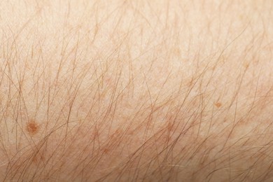 Texture of normal skin as background, closeup